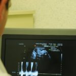 REPRODUCCIÓN ASISTIDA EN LA CLÍNICA DE FERTILIDAD DE LA SSEM